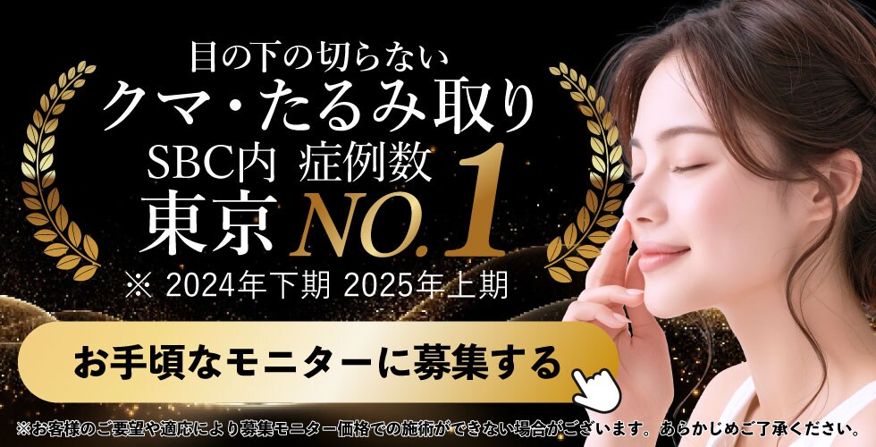 クマ取りモニター募集