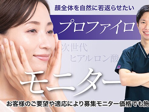 プロファイロモニター