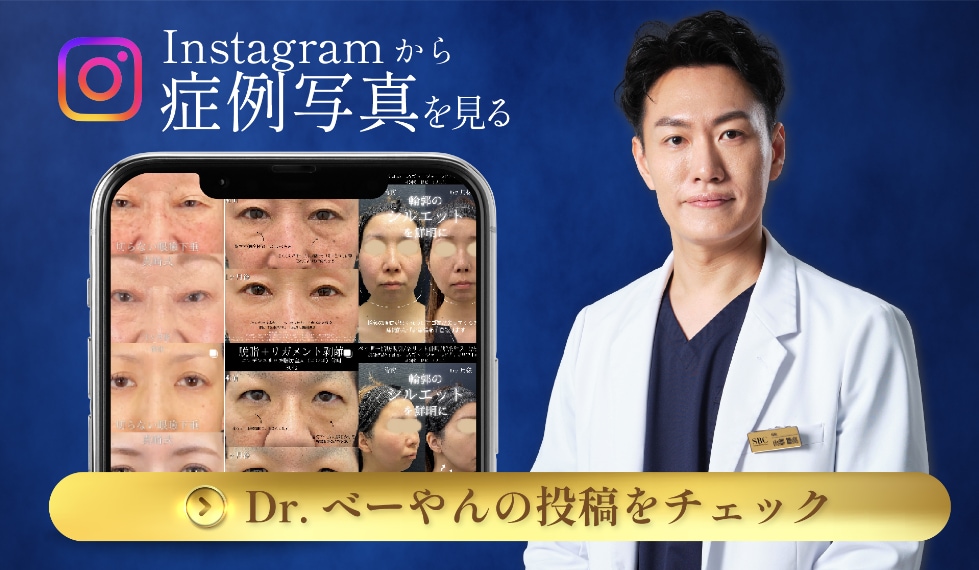 インスタグラム