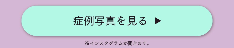 症例写真を見る