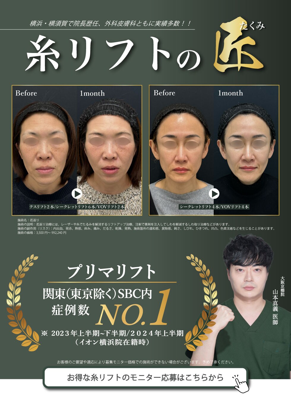 糸リフトの匠