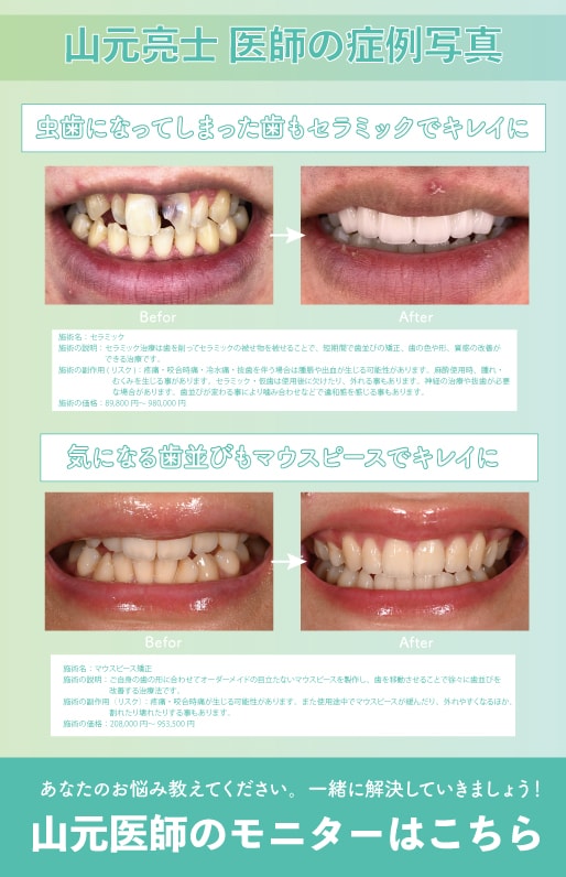 症例モニター募集