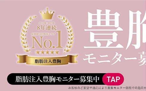 豊胸モニター