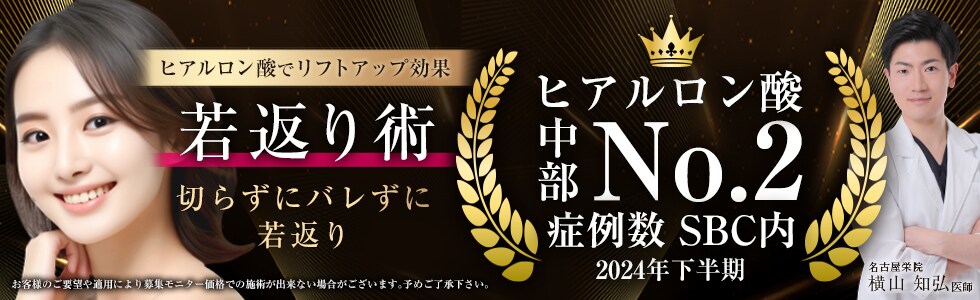 モニター募集