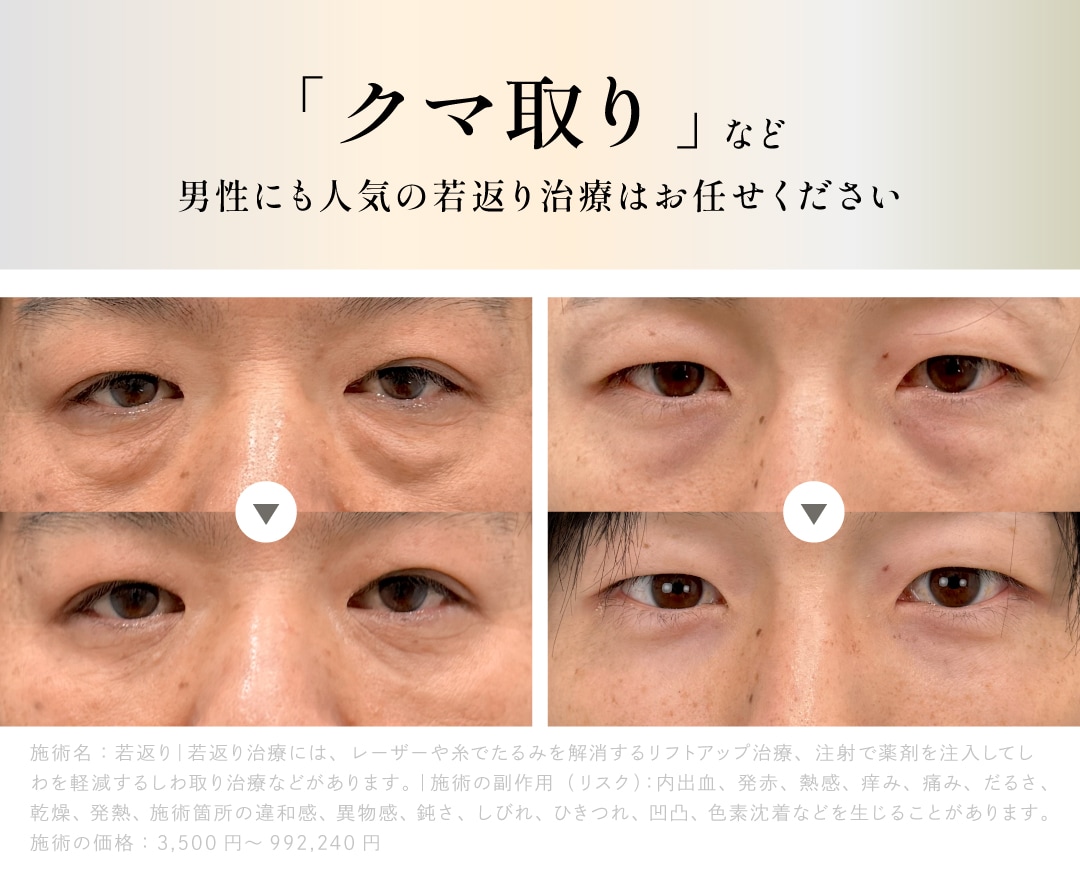 クマ取り