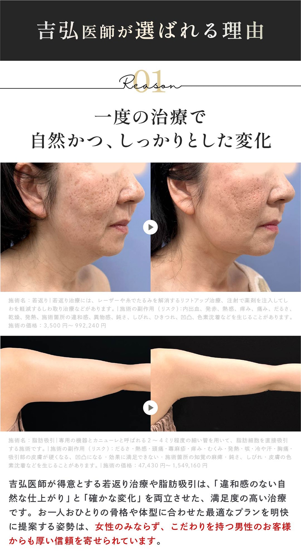 一度の治療で自然かつ、しっかりとした変化