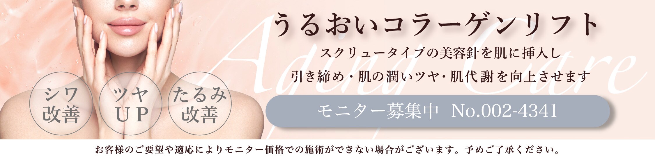 うるこらモニター