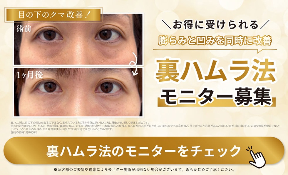 裏ハムラ法モニター募集