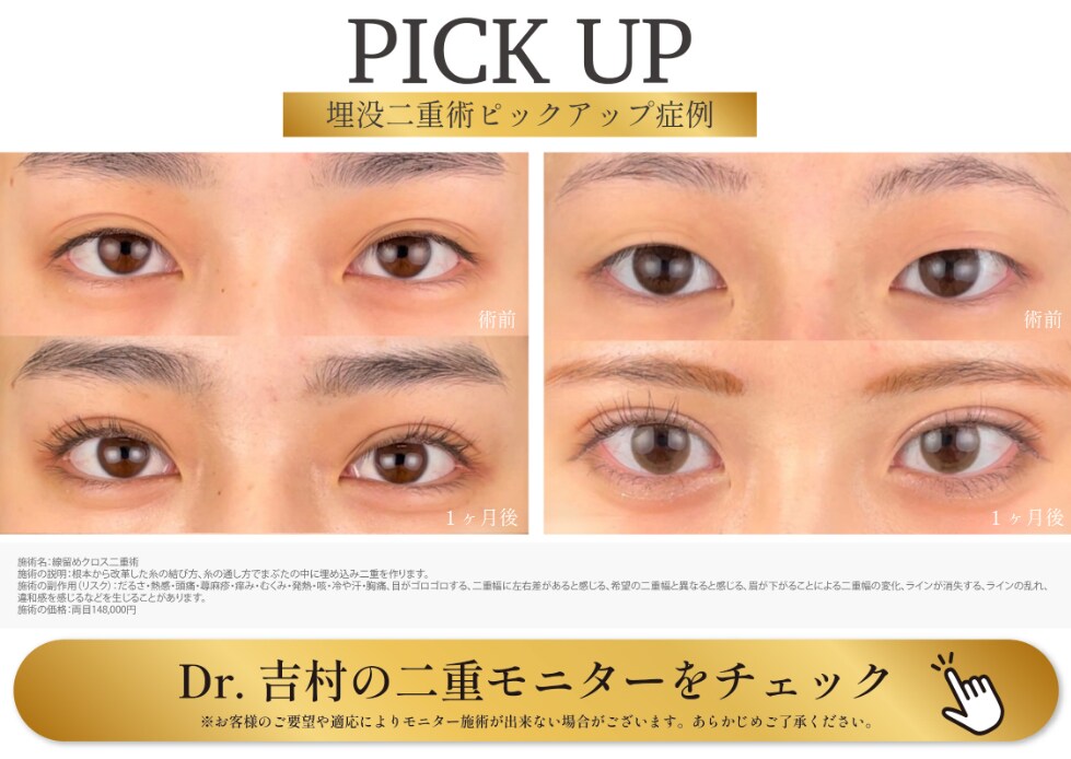 症例PICK UP