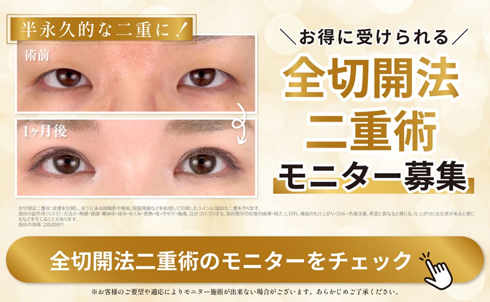 前切開法二重術モニター募集