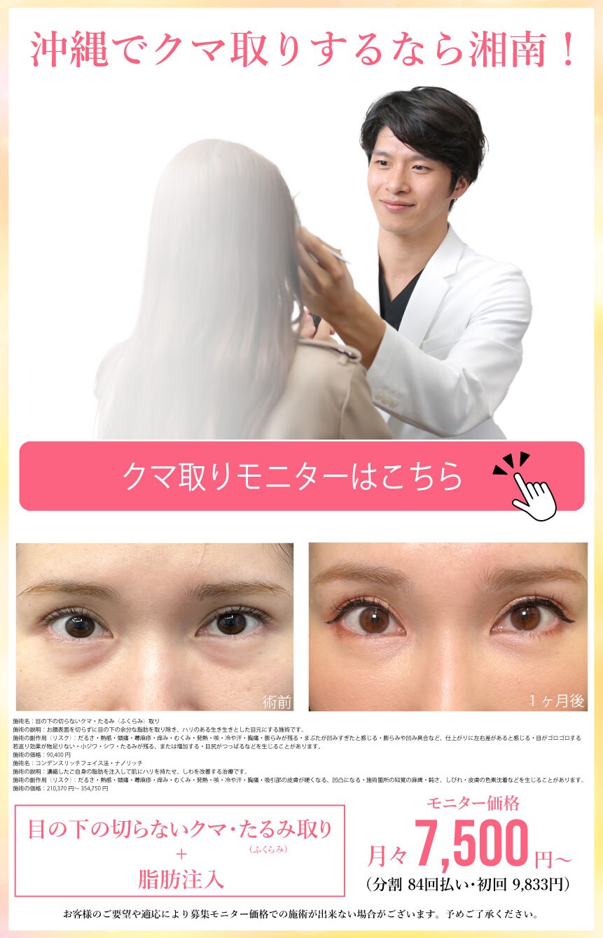 クマ取りモニター募集