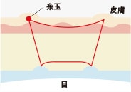 糸