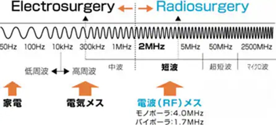 内出血を極限まで抑える工夫 ー RF(電波)メス