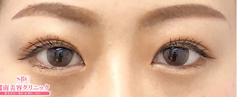 症例214783A