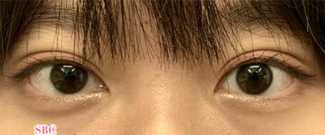 症例201609A