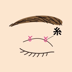 点で二重ラインを作る