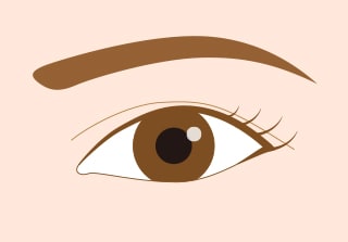 切らない眼瞼下垂 真崎式 Before After