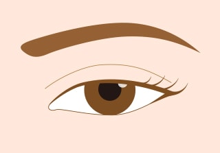 切らない眼瞼下垂 真崎式 Before After