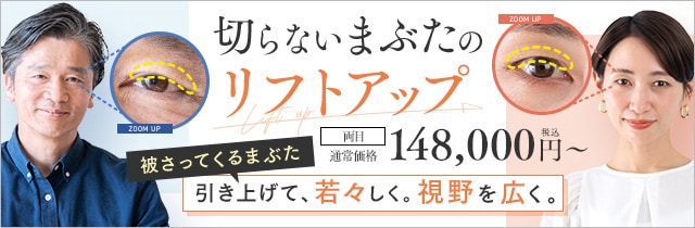 切らないまぶたのリフトアップ