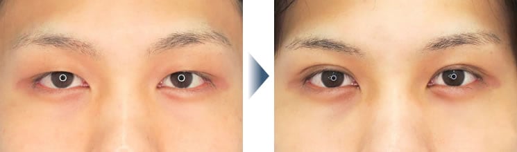 Question.5のBefore/After