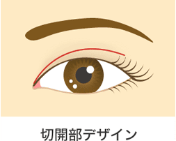 切開部デザイン