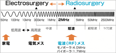 電気メスと電波メス