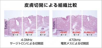 組織比較