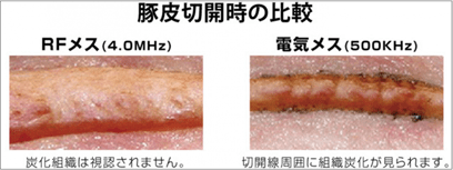 切開時の比較