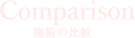 施術の比較