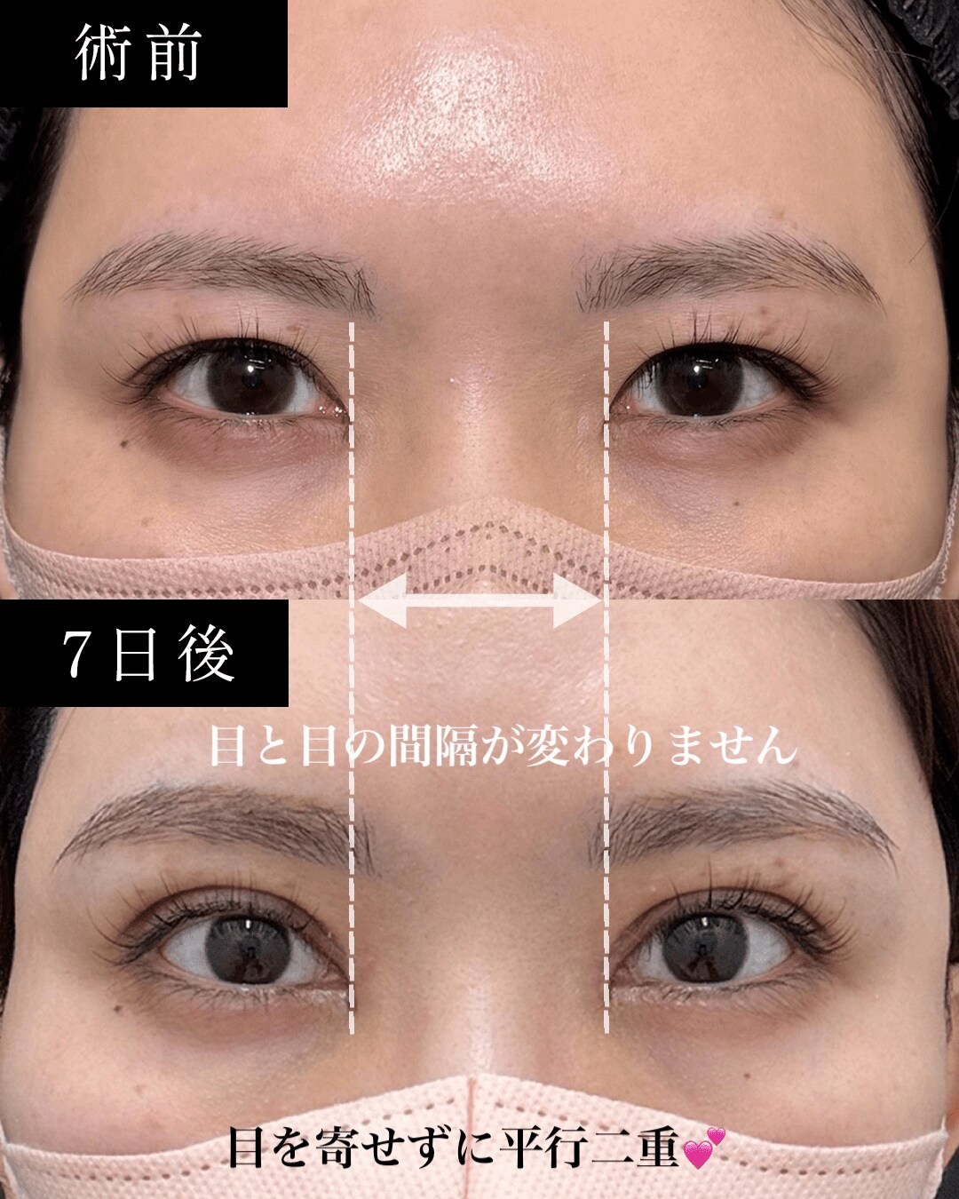 Pick Up症例写真1