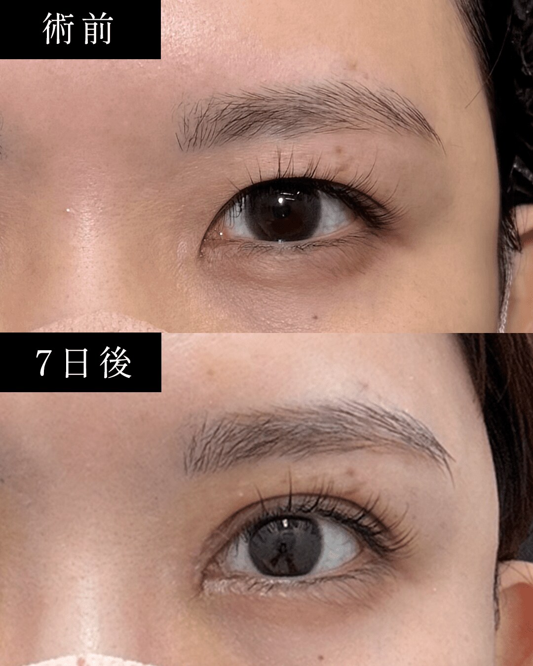 Pick Up症例写真2