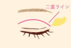 仕上がりの二重ラインに合わせて切開部分から余分な脂肪を丁寧に取り除きます。