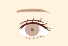 切開部分を丁寧に縫合していきます。手術跡は二重のラインになります。