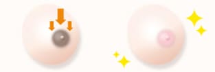 デリケートゾーンや乳輪の黒ずみを手軽に改善したい イメージ