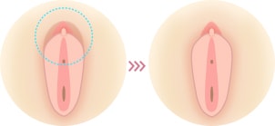 小陰唇と大陰唇の間にヒダがある イメージ