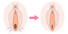 膣を引き締めたい イメージ
