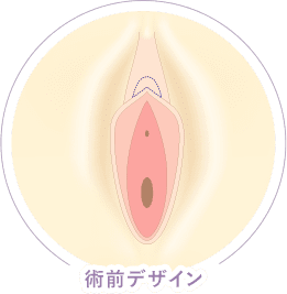 従来法 デザイン イメージ