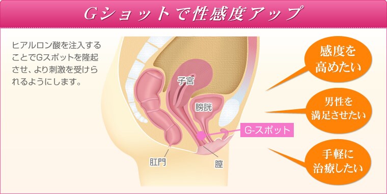 Gショット 感度up手術 婦人科形成なら湘南美容クリニック 公式 Gショット 感度up手術 婦人科形成なら湘南美容クリニック 公式