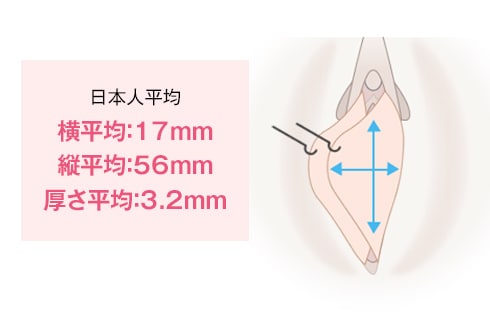 しょういんしん縮小手術