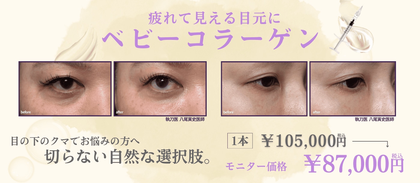 疲れて見える目元に　ベビーコラーゲン