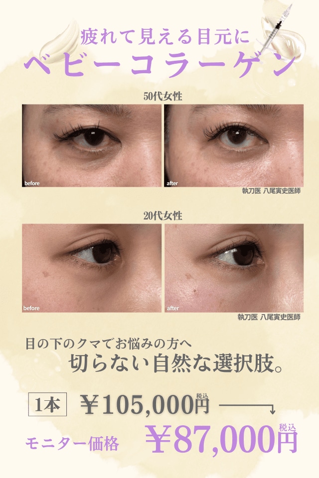 疲れて見える目元に　ベビーコラーゲン