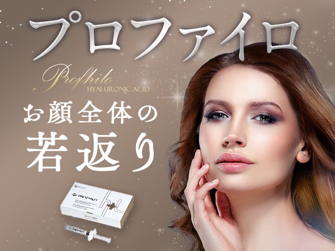プロファイロ