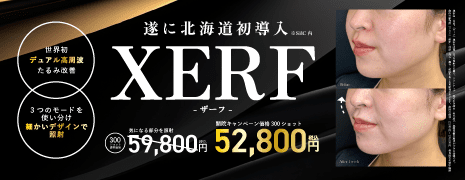 XERF（ザーフ）