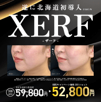 XERF（ザーフ）