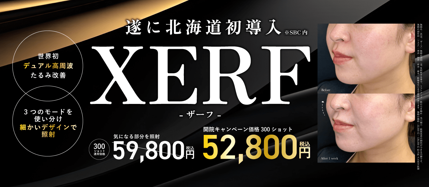 たるみ治療機XERF