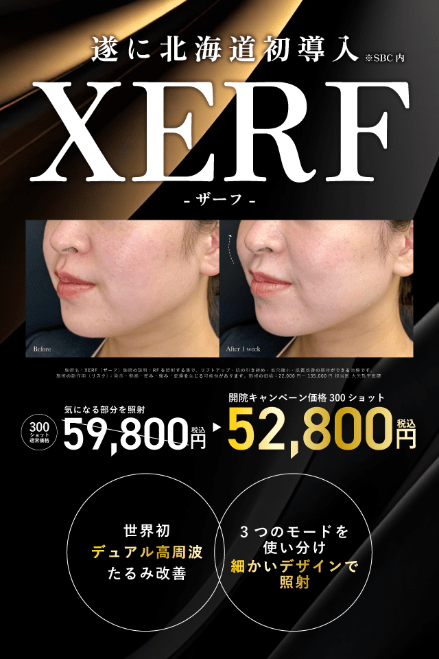 たるみ治療機XERF