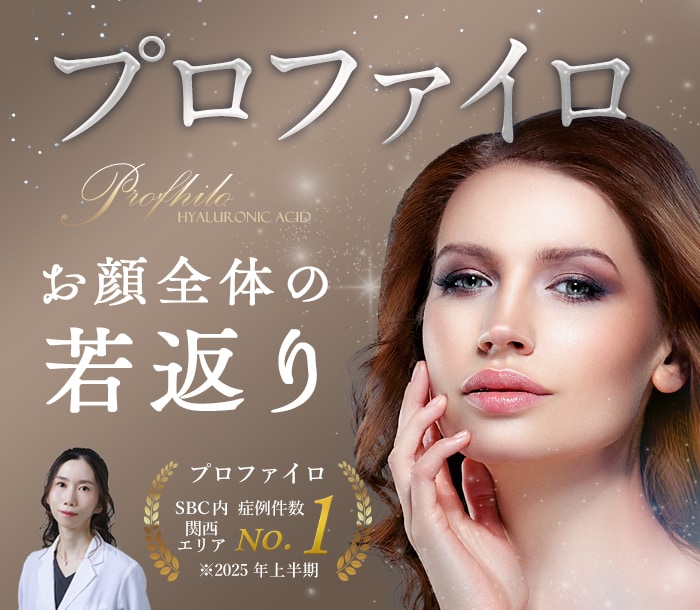 プロファイロ