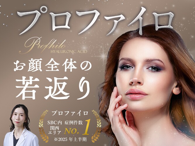 プロファイロ