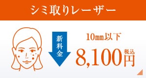 シミ取りレーザー