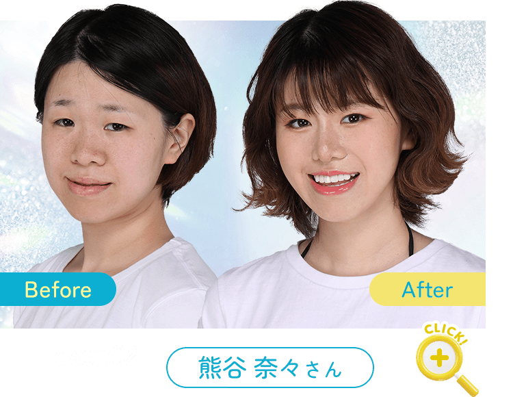 Before After 症例2